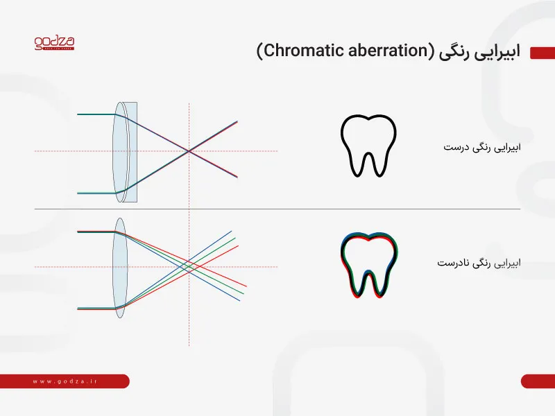 ابیرایی رنگی در لوپ دندانپزشکی