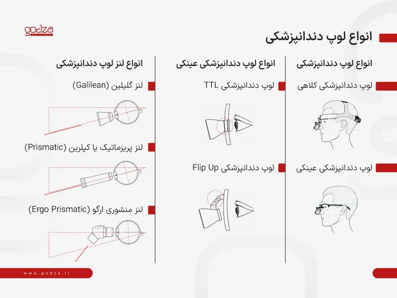 انواع لوپ دندانپزشکی